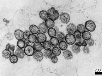 Drei Tote nach Hantavirus-Ausbruch auf Kreuzfahrtschiff Drei Tote nach Hantavirus-Ausbruch auf Kreuzfahrtschiff